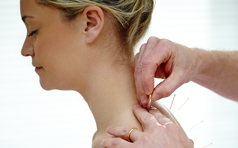 Specialist Sports & Spinal Physiotherapy Nedlands Woman having acupuncture
